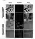 Fig. 06 - Pharmaceutical composition for suppressing cell transplant rejection