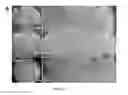 Fig. 09 - Methods for treating and diagnosing blinding eye diseases