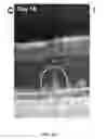 Fig. 32 - Methods for treating and diagnosing blinding eye diseases