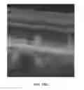 Fig. 33 - Methods for treating and diagnosing blinding eye diseases