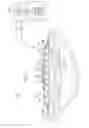 Fig. 02 - Negative pressure therapy with dynamic profile capability