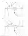 Fig. 02 - Method of flushing an extracorporeal blood circuit