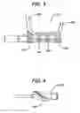 Fig. 03 - Devices and methods for transnasal irrigation or suctioning of the sinuses