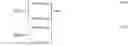 Fig. 44 - System, method, and apparatus for estimating liquid delivery