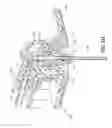 Fig. 07 - Needle shielding assemblies and infusion devices for use therewith