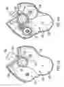 Fig. 06 - MEDICAMENT DISPENSER