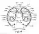 Fig. 12 - MEDICAMENT DISPENSER