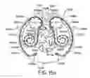 Fig. 16 - MEDICAMENT DISPENSER