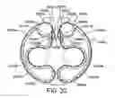 Fig. 23 - MEDICAMENT DISPENSER