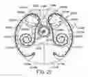 Fig. 25 - MEDICAMENT DISPENSER