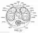 Fig. 26 - MEDICAMENT DISPENSER