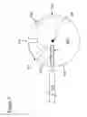 Fig. 09 - Volume-adjustable manual ventilation device