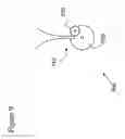 Fig. 13 - Volume-adjustable manual ventilation device