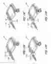 Fig. 17 - Volume-adjustable manual ventilation device