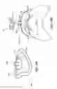 Fig. 23 - Volume-adjustable manual ventilation device
