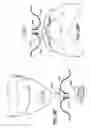 Fig. 24 - Volume-adjustable manual ventilation device
