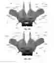 Fig. 22 - Patient interface for respiratory therapy