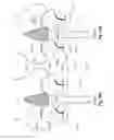 Fig. 28 - Patient interface for respiratory therapy