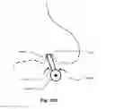 Fig. 41 - Patient interface for respiratory therapy