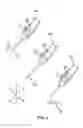 Fig. 03 - Robotically augmented catheter manipulation handle