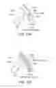 Fig. 40 - Catheter system