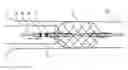 Fig. 01 - ASSEMBLY WITH A GUIDE WIRE AND A FIXATOR FOR ATTACHING TO A BLOOD VESSEL