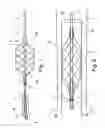 Fig. 02 - ASSEMBLY WITH A GUIDE WIRE AND A FIXATOR FOR ATTACHING TO A BLOOD VESSEL