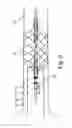 Fig. 03 - ASSEMBLY WITH A GUIDE WIRE AND A FIXATOR FOR ATTACHING TO A BLOOD VESSEL