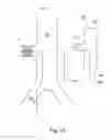 Fig. 08 - ASSEMBLY WITH A GUIDE WIRE AND A FIXATOR FOR ATTACHING TO A BLOOD VESSEL