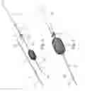 Fig. 15 - ASSEMBLY WITH A GUIDE WIRE AND A FIXATOR FOR ATTACHING TO A BLOOD VESSEL