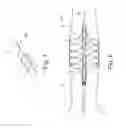 Fig. 16 - ASSEMBLY WITH A GUIDE WIRE AND A FIXATOR FOR ATTACHING TO A BLOOD VESSEL