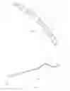 Fig. 07 - Locking medical guide wire