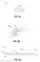 Fig. 03 - Drainage catheter system including a hub