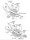 Fig. 05 - Method and apparatus for inserting a rectal suppository