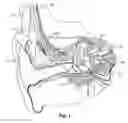 Fig. 02 - Reproducible placement of ABI Electrodes