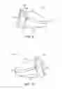 Fig. 06 - Golf club head with flexure