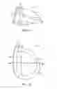 Fig. 07 - Golf club head with flexure