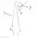 Fig. 01 - Overhead Throwers Train Aid