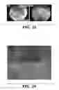 Fig. 35 - Compositions and methods for epithelial stem cell expansion and culture