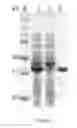 Fig. 04 - Solubility and Affinity Tag for Recombinant Protein Expression and Purification