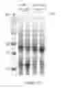 Fig. 06 - Solubility and Affinity Tag for Recombinant Protein Expression and Purification