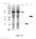 Fig. 07 - Solubility and Affinity Tag for Recombinant Protein Expression and Purification