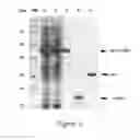 Fig. 11 - Solubility and Affinity Tag for Recombinant Protein Expression and Purification