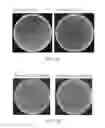 Fig. 05 - Cas9 plasmid, genome editing system and method of 