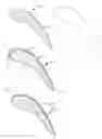 Fig. 01 - REPAIR METHOD FOR TURBINE BLADES