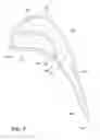 Fig. 08 - Gas turbine engine airfoil