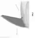 Fig. 03 - BLADE FOR SHROUDED RUNNER AND SHROUDED RUNNER COMPRISING SAID BLADE
