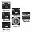 Fig. 04 - System and method for dynamic focus control