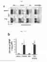 Fig. 02 - Memory invariant NKT cell marker