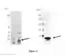 Fig. 02 - Breast Tumor Markers And Methods Of Use Thereof